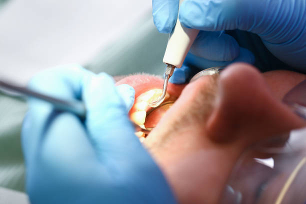 Best Emergency Dentist for Special Needs Patients in Hawkins, TX