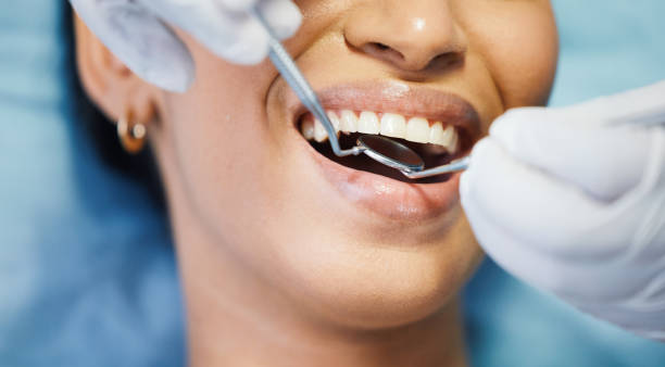 Best Orthodontic Emergency Dentist in Hawkins, TX