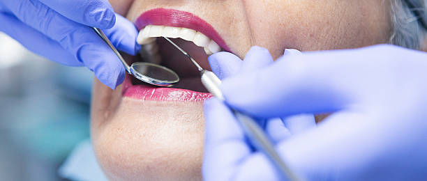 Best Broken or Cracked Tooth Emergency Dentist in Hawkins, TX